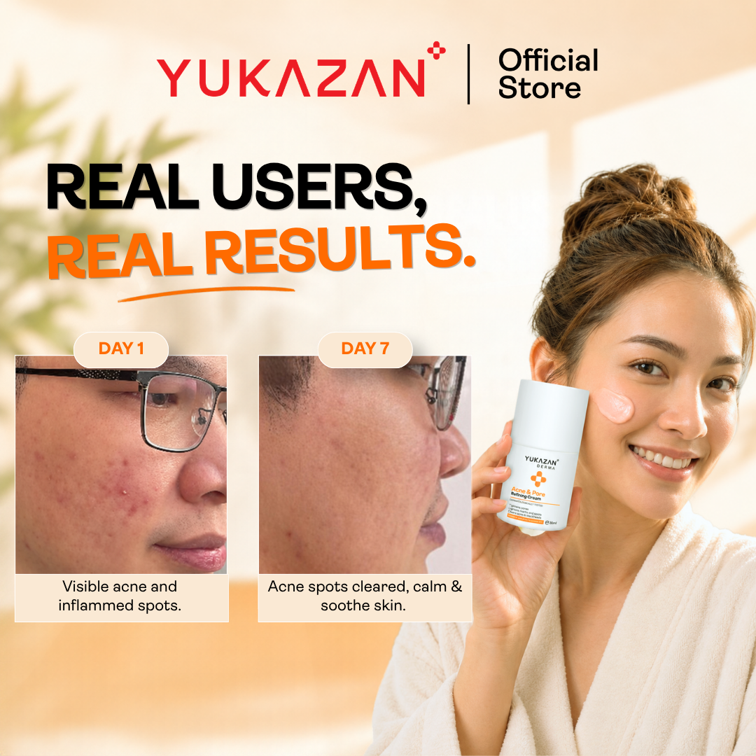 Yukazan Derma Refining Cream Acne & Pore 5ml Acne Removal Cream - Reduce acne in 7 days