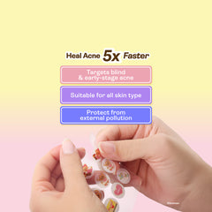 【Yukazan x Butterbear】Microdarts Acne Care Patch 9s | Microneedle Patches for Blind Pimples | Pure Hydrocolloid Skincare